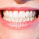 teeth-smile